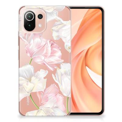 Xiaomi Mi 11 Lite | 11 Lite 5G NE | TPU Case | Lovely Flowers