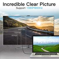 Mini DisplayPort-kabel Vention HABBH Zwart 2 m - thumbnail