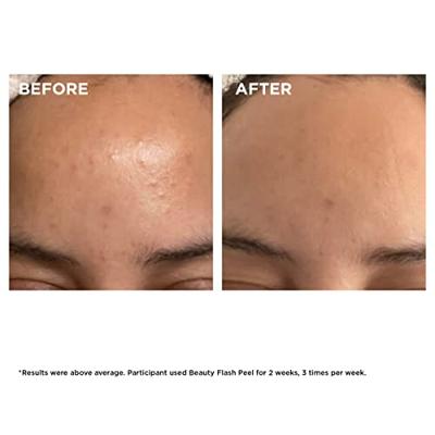 Clarins Exfoliators Beauty Flash Peel Peeling 50ml