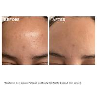 Clarins Exfoliators Beauty Flash Peel Peeling 50ml - thumbnail