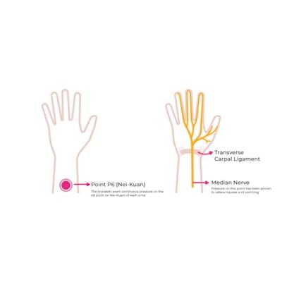 Sea Band Polsband zwangerschap roze 1 Paar