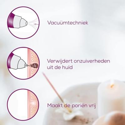 Vacuümreiniger voor gezichtsporen Beurer 584.17 3W Wit - thumbnail