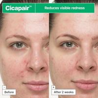 Dr. Jart+ Cicapair So Soothing Treatment 30 ml - thumbnail