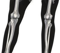 Ballerina Skelet Met Tutu Zwart Vrouw - thumbnail