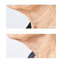 Perricone MD Sub D/Neck 59ml - thumbnail