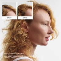 Nioxin System 4 Loyalty Kit - thumbnail