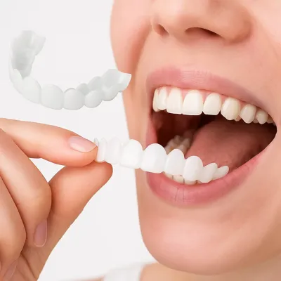 Deepsleep Snapon Smile Nep tanden boven en onder - Witte tanden