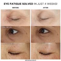 IT Cosmetics Confidence In An Eye Cream 15ml Oogverzorging - thumbnail