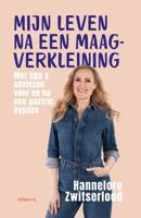 Mijn leven na een maagverkleining - Hannelore Zwitserlood - ebook - thumbnail