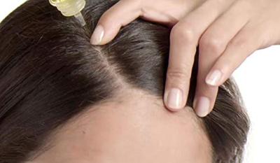 Simply Zen stimulating scalp lotion 8 ampullen à 6 ml