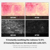 Medicube Super Cica Toner Pad 70 stuk 70 pc - thumbnail