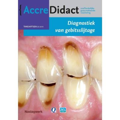 Diagnostiek van gebitsslijtage (Paperback)