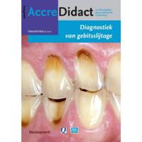Diagnostiek van gebitsslijtage (Paperback) - thumbnail