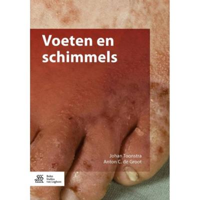Voeten en schimmels (Paperback) Voeten en schimmels (Paperback)