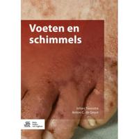 Voeten en schimmels (Paperback) - thumbnail