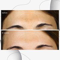 Dermalogica Powerbright Dark Spot Serum - thumbnail