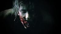 Resident Evil 2 - thumbnail
