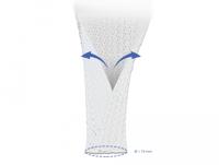 Kabelmantel met klittenbandsluiting 2 m x 19 mm wit - thumbnail