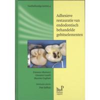 Adhesieve restauratie van endodontisch behandelde gebitselementen - F. Mannocci, G. Cavalli, M. Gagliani - Hardcover (9789085620587) - thumbnail