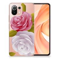 Xiaomi Mi 11 Lite | 11 Lite 5G NE | TPU Case | Roses - thumbnail