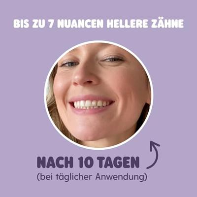 Smyle Tandenbleek set - thumbnail
