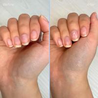 Herome Essentials set voor droge & geribbelde nagels 1 Set - thumbnail