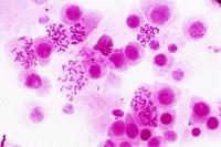 BRESSER Microscoop preparaten 30 stuks - Histologie - thumbnail