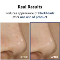 Isntree Hyper Acid 4 AHA,BHA,PHA,LHA 30 Serum 20 ml - thumbnail