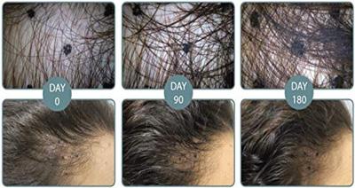 Viviscal Hair Growth Tablets Man