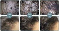 Viviscal Man Hair Growth Supplement - thumbnail