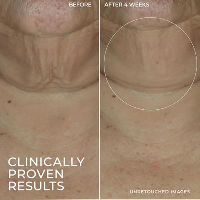 RoC Derm Correxion Firming Serumstick RoC Derm Correxion Firming Serumstick