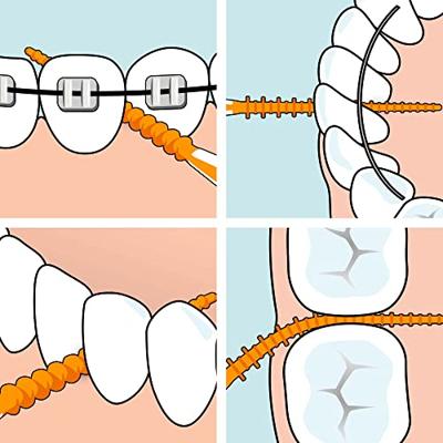 Tepe Easypick Orange Xs/s 36 Stuks - thumbnail