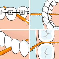 TePe Easypick XS/S - thumbnail