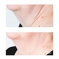 Perricone MD Sub D/Neck 59ml - thumbnail