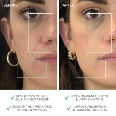 Foreo Luna 3 Facial Cleansing en Firming Massager voor Combination Foreo Luna 3 Facial Cleansing en Firming Massager voor Combination