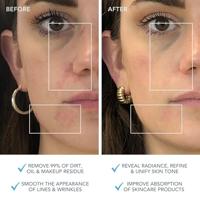 Foreo Luna 3 Facial Cleansing en Firming Massager voor Combination - thumbnail