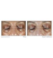 RoC Multi Correxion Even Tone & Lift Eye Cream 15 ml Oogverzorging - thumbnail