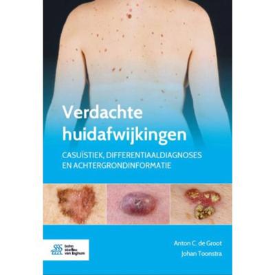 Verdachte huidafwijkingen (Paperback)