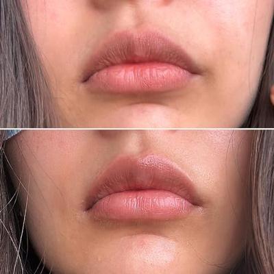 Lipbalsem Talika Smile Hydraterend Lippen