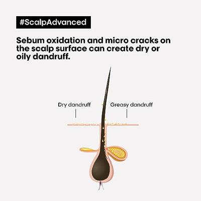 L&apos;Oréal Professional Scalp Advanced Anti-Dandruff Dermo-Clarifier Shampoo (voor een hoofdhuid met roos/schilfers) - thumbnail