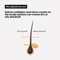 L&apos;Oréal Professional Scalp Advanced Anti-Dandruff Dermo-Clarifier Shampoo (voor een hoofdhuid met roos/schilfers) - thumbnail