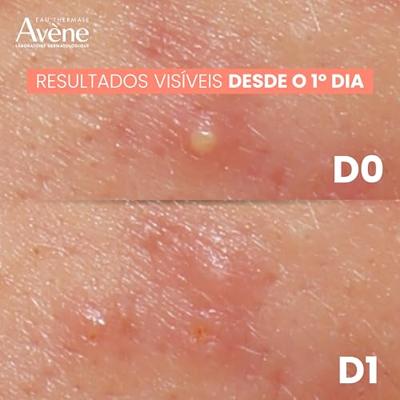 Avène Cleanance Comedomed Peeling 40ml - thumbnail