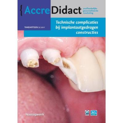 Technische complicaties bij implantaatgedragen constructies (Paperback)