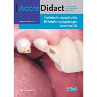 Technische complicaties bij implantaatgedragen constructies (Paperback) - thumbnail