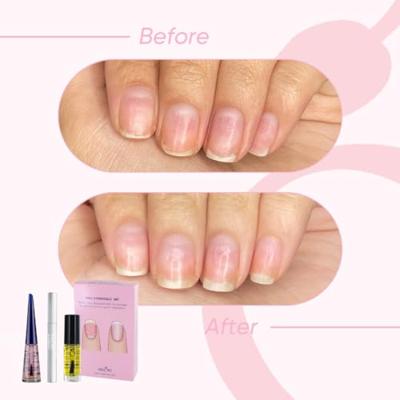 Herome Essentials set voor zeer beschadigde nagels 1 Set
