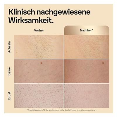 Braun Skin i-expert Smart IPL ontharingsapparaat PL5382