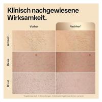 Braun Skin i-expert Smart IPL ontharingsapparaat PL5382 - thumbnail