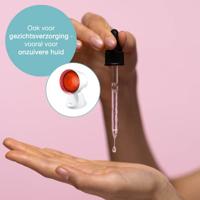 Sanitas SIL16 Infraroodlamp 150 W - thumbnail