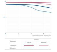 Samyang 7,5mm T3.8 UMC VDSLR Micro 4/3 Zwart - thumbnail