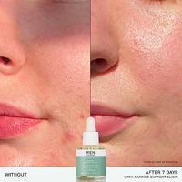 REN Evercalm Barrier Support Elixir 30ml - thumbnail